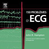 150 problèmes d ECG