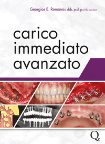 Carico immediato avanzato - Georgios E. Romanos