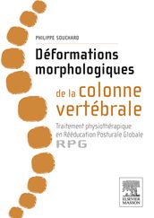 Déformations morphologiques de la colonne vertébrale