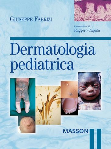 Dermatologia pediatrica - Giuseppe Fabrizi