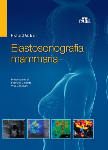 Elastosonografia mammaria - Richard Barr