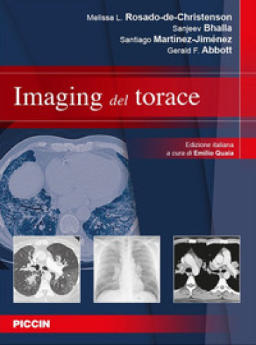 Imaging del torace - Melissa L. Rosado-de-Christenson - Sanjeev Bhalla - Santiago Martínez-Jiménez - Gerald F. Abbott