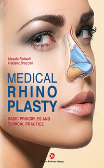 Medical rhinoplasty. Basic principles and clinical practice - Alessio Redaelli - Frederic Braccini