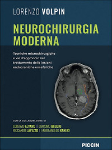 Neurochirurgia moderna. Tecniche microchirurgiche e vie d'approccio nel trattamento delle lesioni endocraniche encefaliche - Lorenzo Volpin