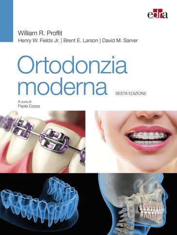 Ortodonzia moderna - 6 ed. - Brent E. Larson - David M. Sarver - Henry W. Fields - William R. Proffit