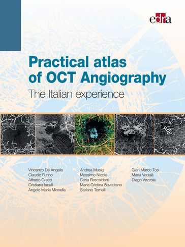 Practical atlas of OCT Angiography - Alfredo Greco - Andrea Musig - Angelo Maria Minnella - Carla Rescaldani - Claudio Furino - Cristiana Iaculli - Diego Vezzola - Gian Marco Tosi - Maria Cristina Savastano - Maria Vadalà - Massimo Nicolò - Stefano Torrielli - Vincenzo De Angelis