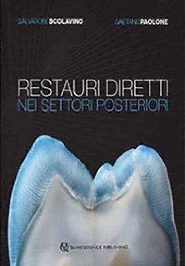 Restauri diretti nei settori posteriori - Salvatore Scolavino - Gaetano Paolone