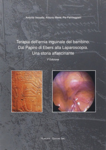 Terapia dell'ernia inguinale del bambino. Dal papiro di Ebers alla laparoscopia. Una storia affascinante - Antonio Vessella - Antonio Marte - Pio Parmeggiani